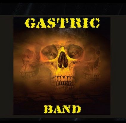 Gastric Band